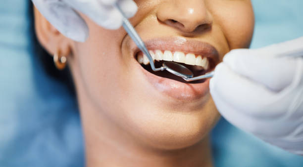 Best Mobile Emergency Dentist in Clton, IN